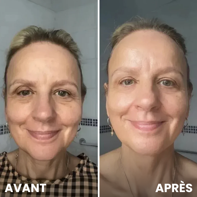 Crème Celyn contour des yeux, lift et éclat instantanés
