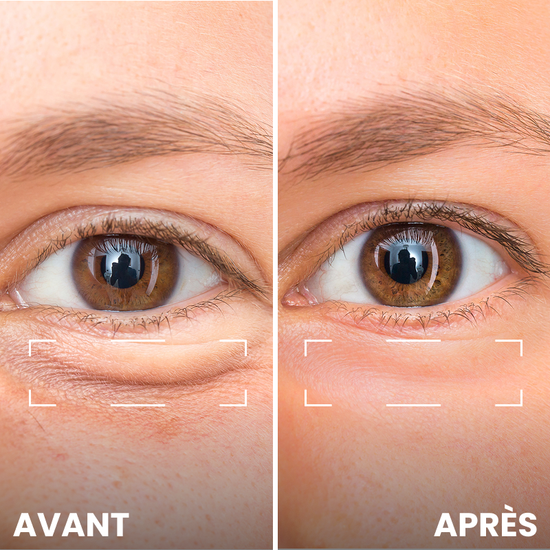 Crème Celyn contour des yeux, lift et éclat instantanés
